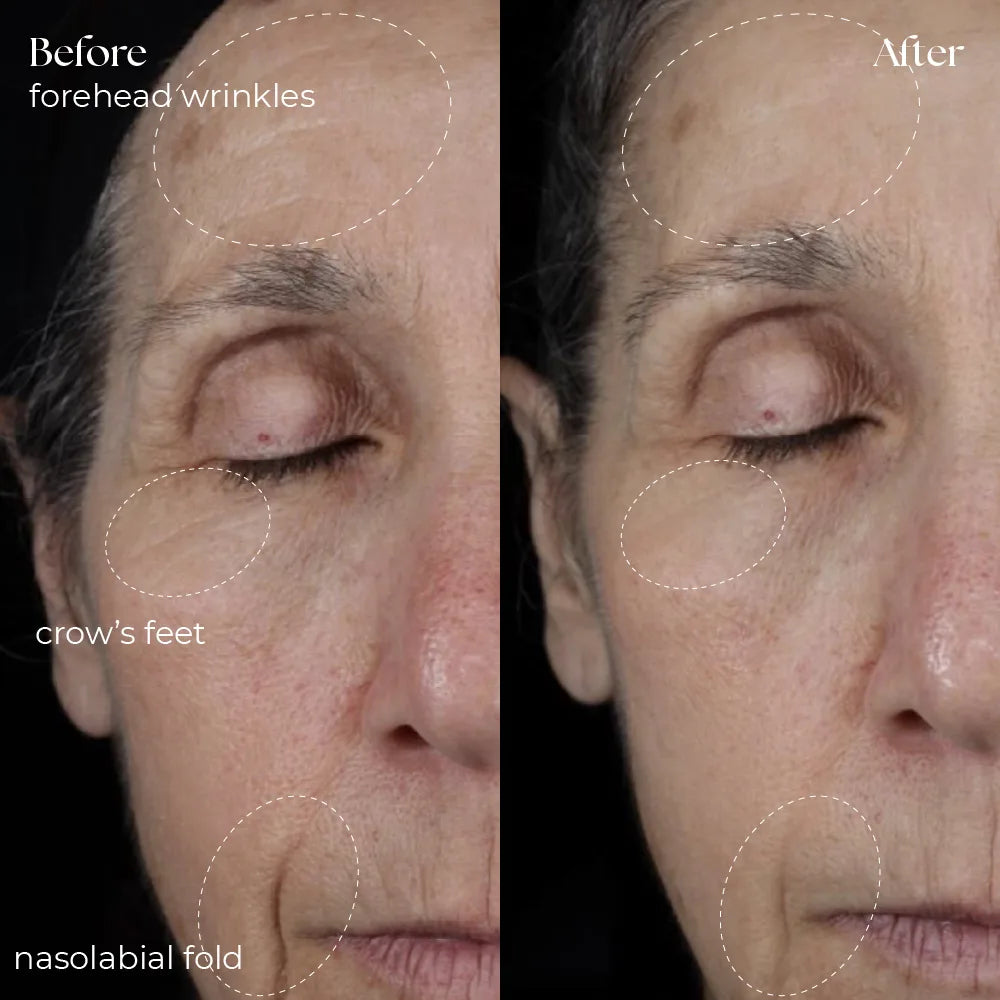 GlowLift™ Infinity | 5-In-One Sculptor & Radiance Booster